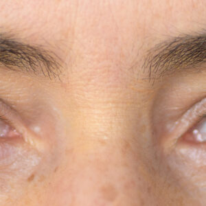 Accessi oculari