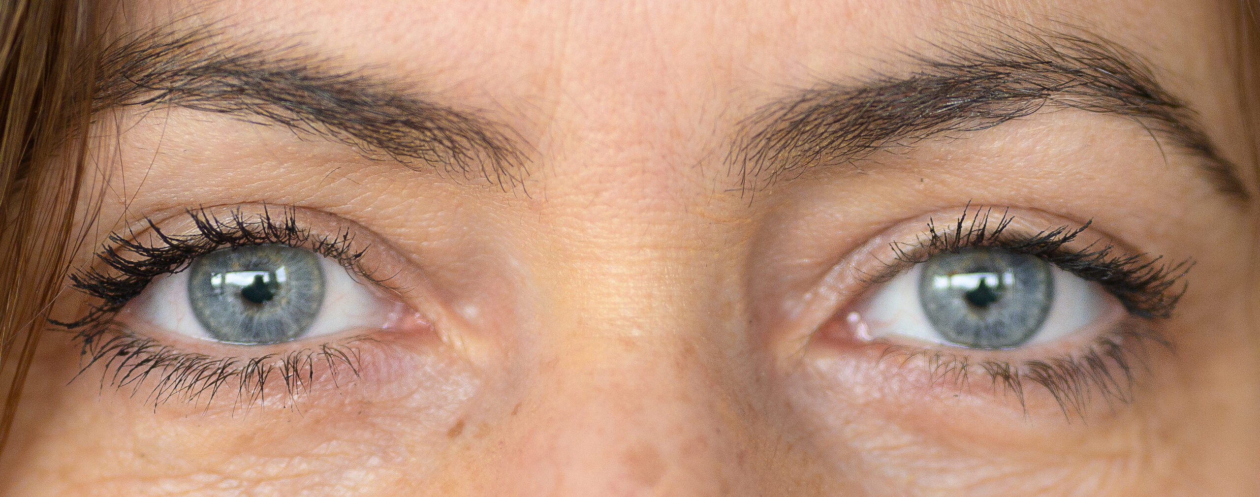 Accessi oculari